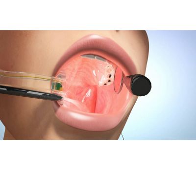 Dentozone eBite (Electronic Bite) - беспроводная система интраоральной подсветки и аспирации