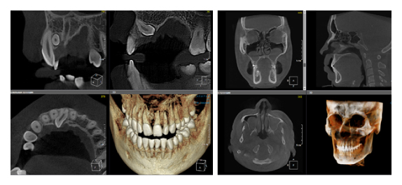 Критерии выбора конусно-лучевого компьютерного томографа.-03 (1).jpg