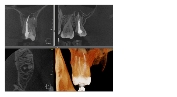Критерии выбора конусно-лучевого компьютерного томографа.-06 (1).jpg