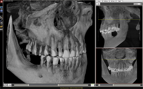 FONA XPan 3D - рентгенографическая цифровая система панорамной съемки