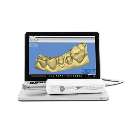 MHT 3D Progress - интраоральный сканер беспорошковый