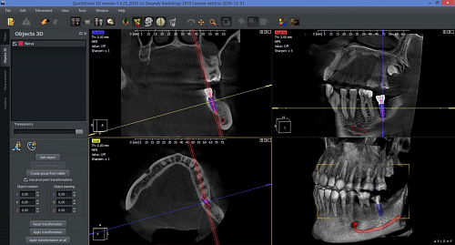 Owandy I-Max Touch 3D – Конусно-лучевой томограф 9х8