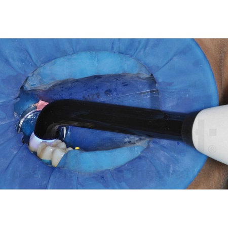 Ivoclar Vivadent Bluephase Style - беспроводная светодиодная полимеризационная лампа