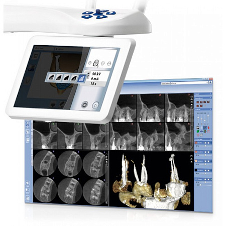 Planmeca ProMax 3D Mid - аппарат 3D визуализации